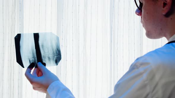 Doctor Looking at Hand Fingers Xray Closeup