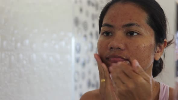 Close-up shot of a young asian woman applying acne clearing cleanser on her chicks and forehead tryi