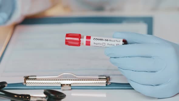 Close Up of Doctors Hand Holding Tube with Positive Blood Test for COVID-20