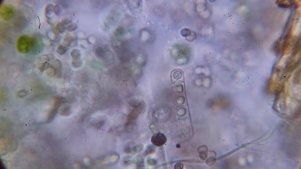 time lapse of cells and protozoa under a microscope