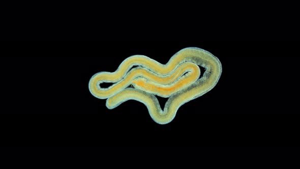 A worm under a microscope, long, like a parasitic. Part of the worm