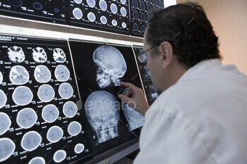 Doctor pointing to skull xray image on lightbox