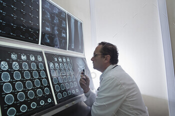 Doctor staring at scans of the brain on lightbox