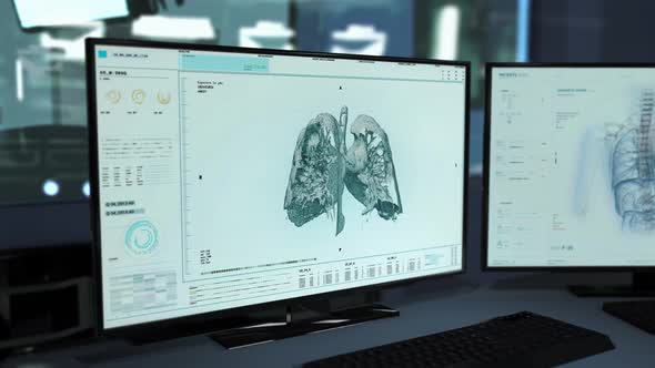 Diagnostic Examination Of Lung Organ In Modern X-ray Medical Computer System alt