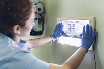 Female dentist looking at dental x-ray on lightbox