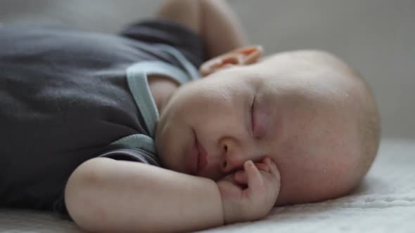 Closeup Sleeping Baby with Dermatitis on Face Forehead Infant on White Blanket