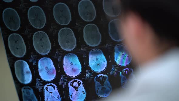 Doctor Locking X-ray Of The Skull