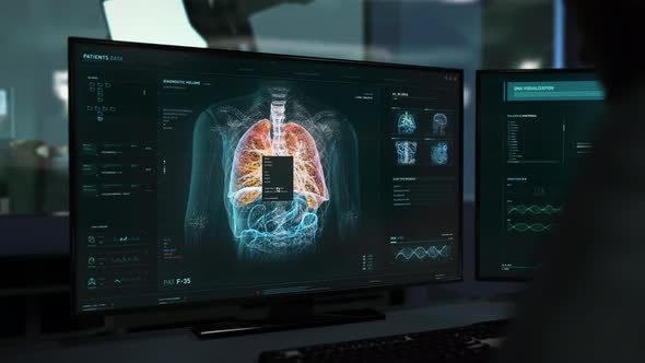 Biological Research Of Lungs In Modern Medical Software Displayed On Screen alt