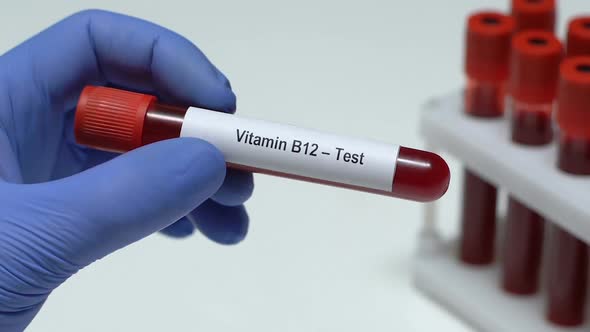 Vitamin B12-Test, Doctor Holding Blood Sample in Tube Close-Up, Health Check-Up