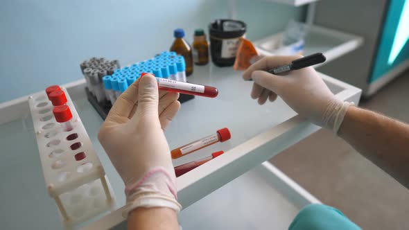 Arm of Scientist in Protective Gloves Tests Test Tube with Blood Sample to Coronavirus alt
