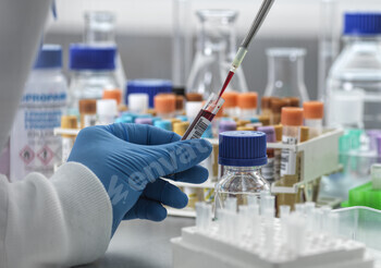 Hand in glove pipetting blood sample in lab