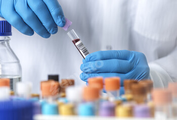 Scientist holding a blood sample in a lab