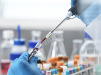 Lab technician pipetting a blood sample