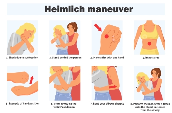 Heimlich Maneuver Infographic Poster with Steps of