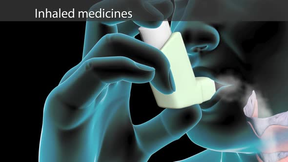 Asthma, Ways to Take Inhaled Medicines