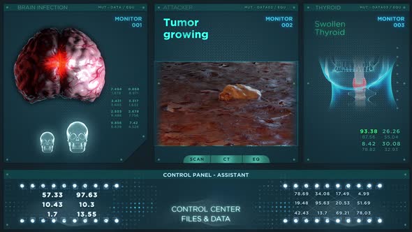 Tumor Growing Medical HUD