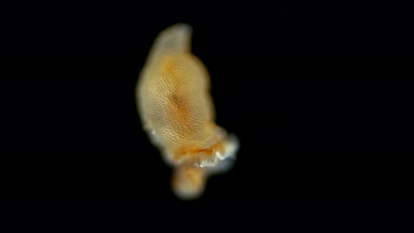 A Worm Larva Under a Microscope, at the Stage of Pelagosphaera, Phylum Sipuncula, Clade