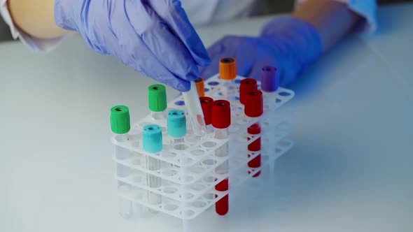 Blood sample for testing. Close up of doctor hand holding blood sample