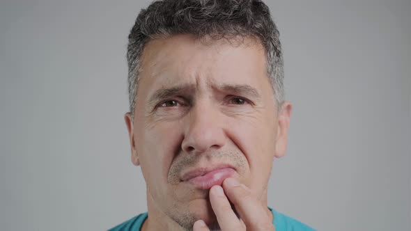 Allergic Reaction on a Man's Lip After a Bee Sting