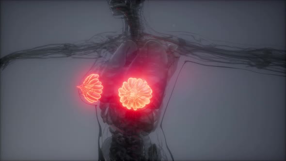 Medically Accurate Illustration of an Obese Womens Mammary Glands alt