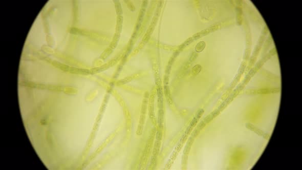 Movement of Live Algae Under a Microscope