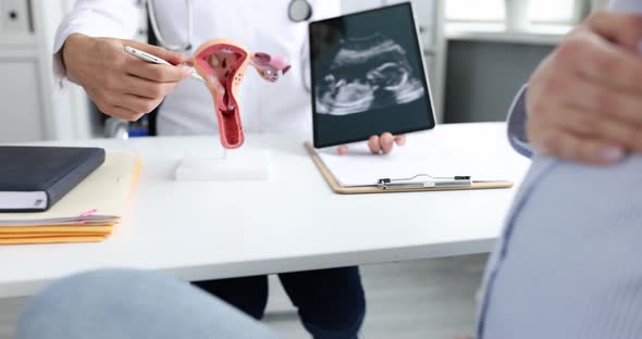 Gynecologist Shows Female Reproductive System Ultrasound Fetus Pregnant Woman
