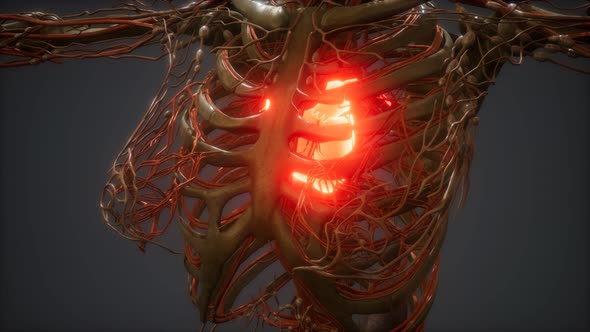 CG Animation Of A Sick Human Heart