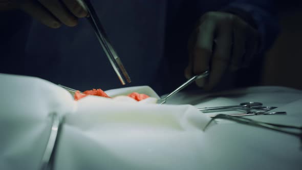 Closeup Surgeon Hands Operating in Clinic Sterile Ward