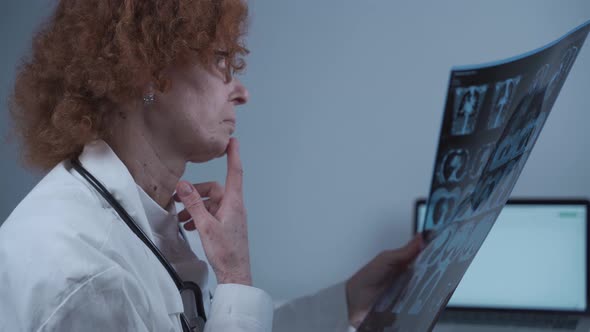 Mature Caucasian Woman Doctor Radiologist Examining CT Scan of Patient's Chest and Lungs in Hospital