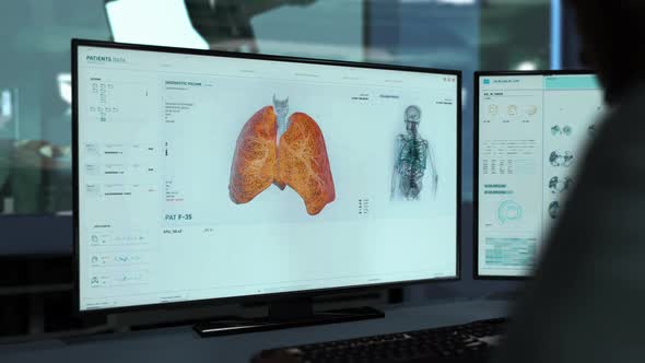 Computer For Medical Diagnosis Analysis Discovers Dangerous Cancer Illness