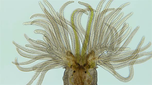 Worm Manayunkia Baicalensis Under a Microscope, of the Family Fabriciidae