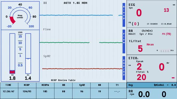 ECG Warns Of Vital Signs In Emergency Condition During Health Analysis