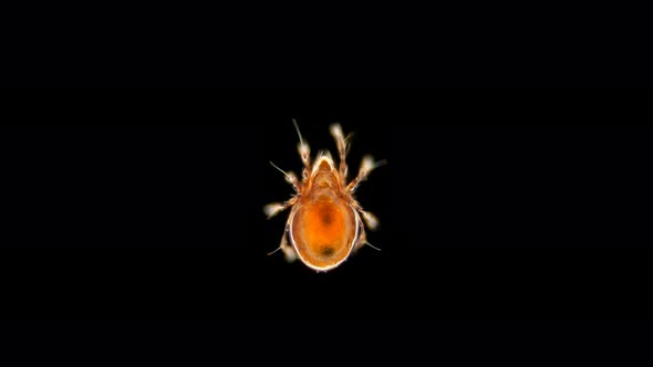 Mite Oribatida Under Microscope Are Saprosphago, Scavengers, Some Species of Predators, Order