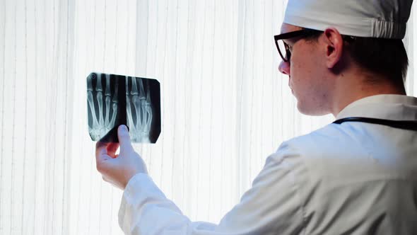 Doctor Looking at Hand Fingers Xray Closeup