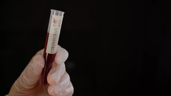 Hand in Glove Holding Blood Sample with Coronavirus Infection