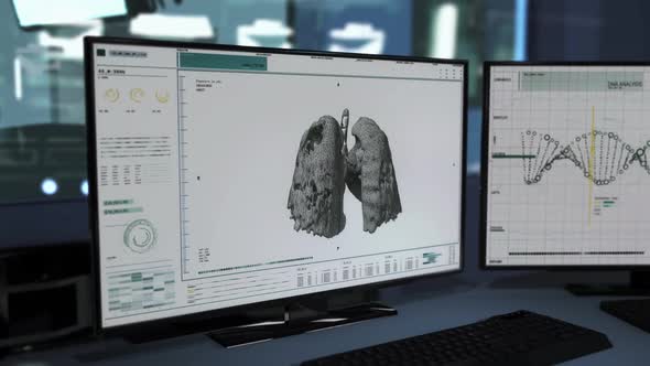 Identifying Covid-19 Pneumonia after the deep analysis of the Genetic Code alt