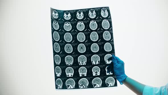 Xray Magnetic Resonance Image of Head