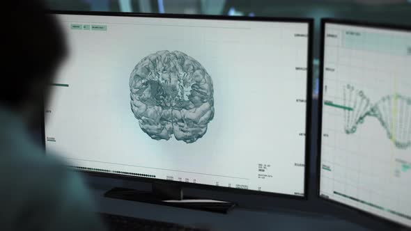 A doctor has detected a brain tumor in the Patient's skull at the laboratory alt