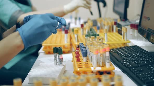 Many Medical Test Tubes with Blood Tests on the Table in the Laboratory