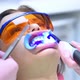 Dentist With Assistant Using Ultraviolet Lamp On Patients Teeth. - VideoHive Item for Sale