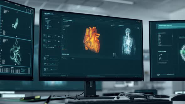 Diagnosing the patient with Cardiac Ischemia after the scanning of a heart organ alt
