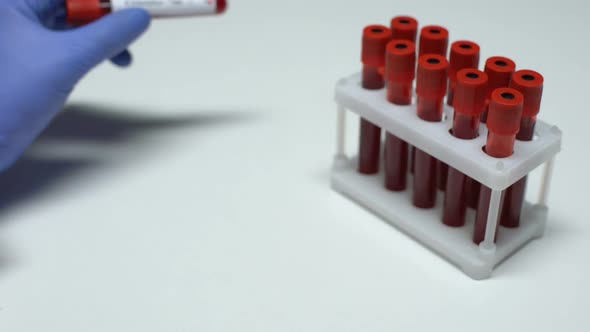 Positive E Histolytica Test, Doctor Showing Blood Sample in Tube, Health Checkup
