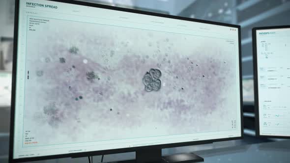 Infectious Bacteria Spreading Examination Via Scientific Computer Program alt