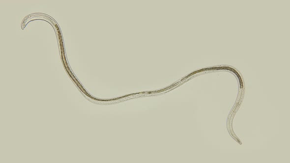 A Nematode Worm Under a Microscope, There Are Free-living, Commensals and Parasites