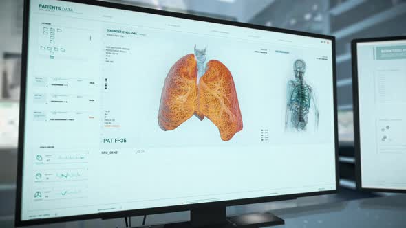 X-ray scanner is analyzing the lung condition before the cancer treatment