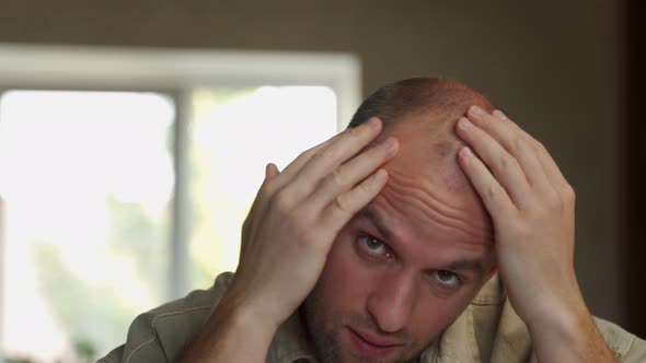 Unhappy Man Checking His Hairstyle in the Mirror Looks at the Bald Spot on His Head Hair Loss