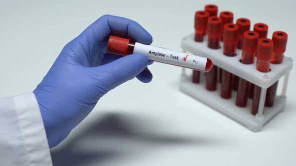 Negative Amylase Test, Doctor Showing Blood Sample, Lab Research, Health Checkup