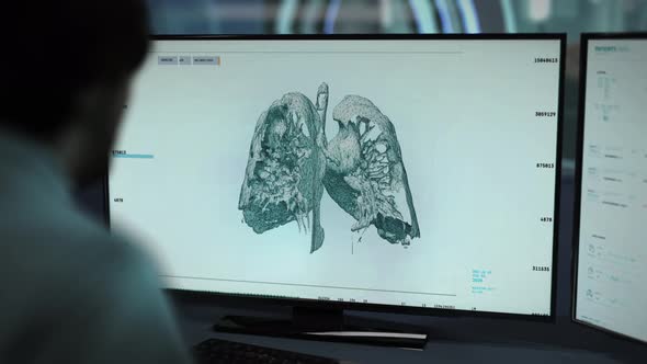 Doctor Observes Computer Scanner Monitoring Ill Patients Lungs Health Condition alt