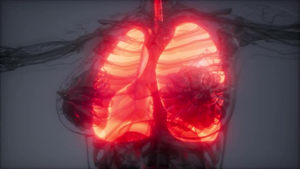 Human Lungs Radiology Exam alt