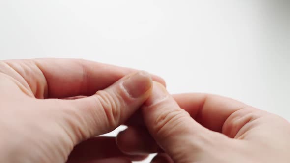 Close Up of Brittle Nails on Woman Hand